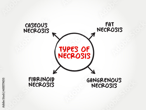 Types of Necrosis (death of body tissue) mind map text concept for presentations and reports photo