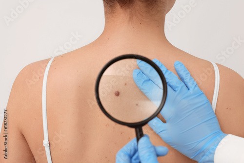 Dermatologist examining patient's birthmark with magnifying glass on beige background, closeup