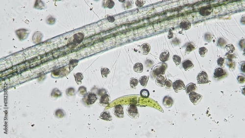 Vorticellidae colony on the Lemna root with closterium paracerosum algae in the background. Image from optical microscope with 10x objective
