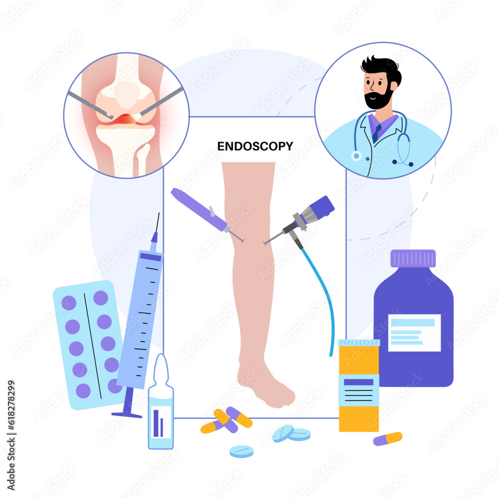 Knee joint arthroscopy Knee joint arthroscopy