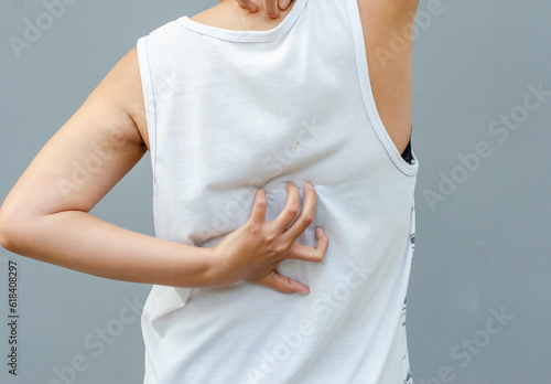 young asian woman scratching itch with hand on dorsal area, health care concept, dermatosis photo