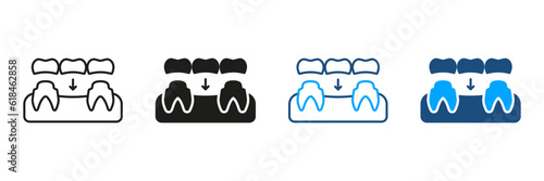 Dental Bridge Silhouette and Line Icon Set. Porcelain Denture, Tooth Regeneration Pictogram. Partial Teeth Implant Restoration. Dental Treatment Symbol Collection. Isolated Vector Illustration