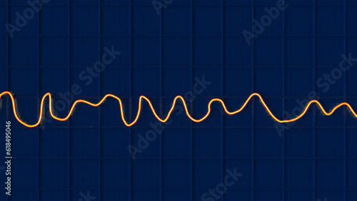 Electrocardiogram ECG displaying ventricular fibrillation rhythm, 3D illustration