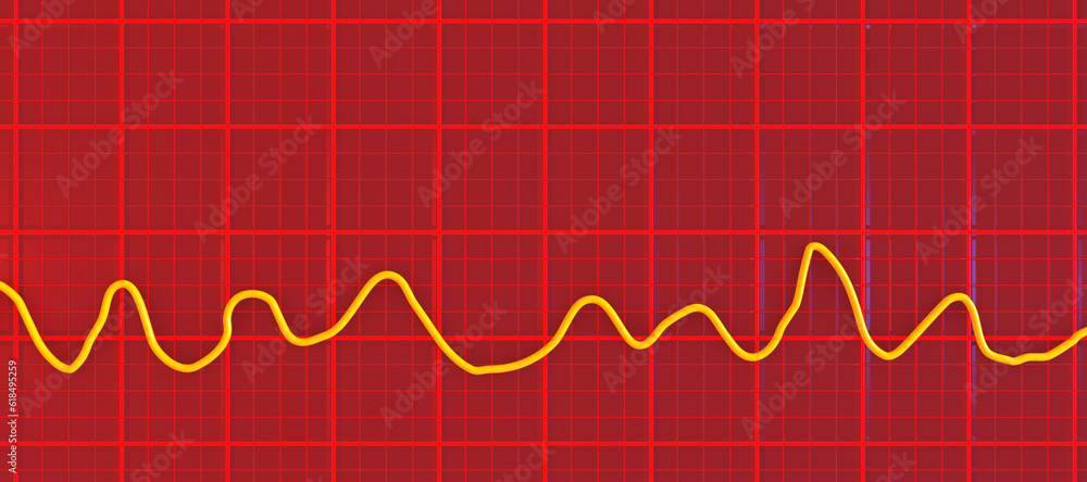 Naklejka premium Electrocardiogram ECG displaying ventricular fibrillation rhythm, 3D illustration