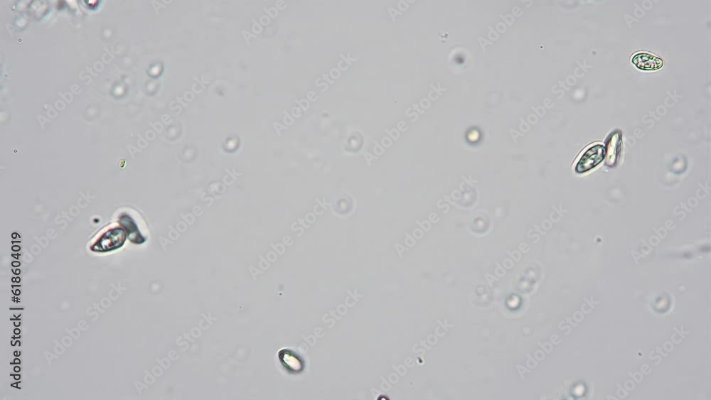 Chaotic movement of protozoa in fresh water. Optical microscope with objective 10x Chaotic movement of protozoa in fresh water. Optical microscope with objective 10x