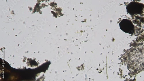 Chaotic movement of protozoa with rotifer floats top to bottom in fresh water. Optical microscope with objective 10x
