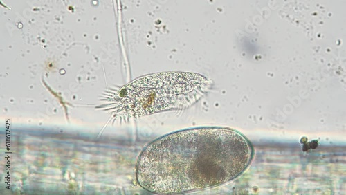 Hypotrich floatin near lemna root. Optical microscope with objective 40x