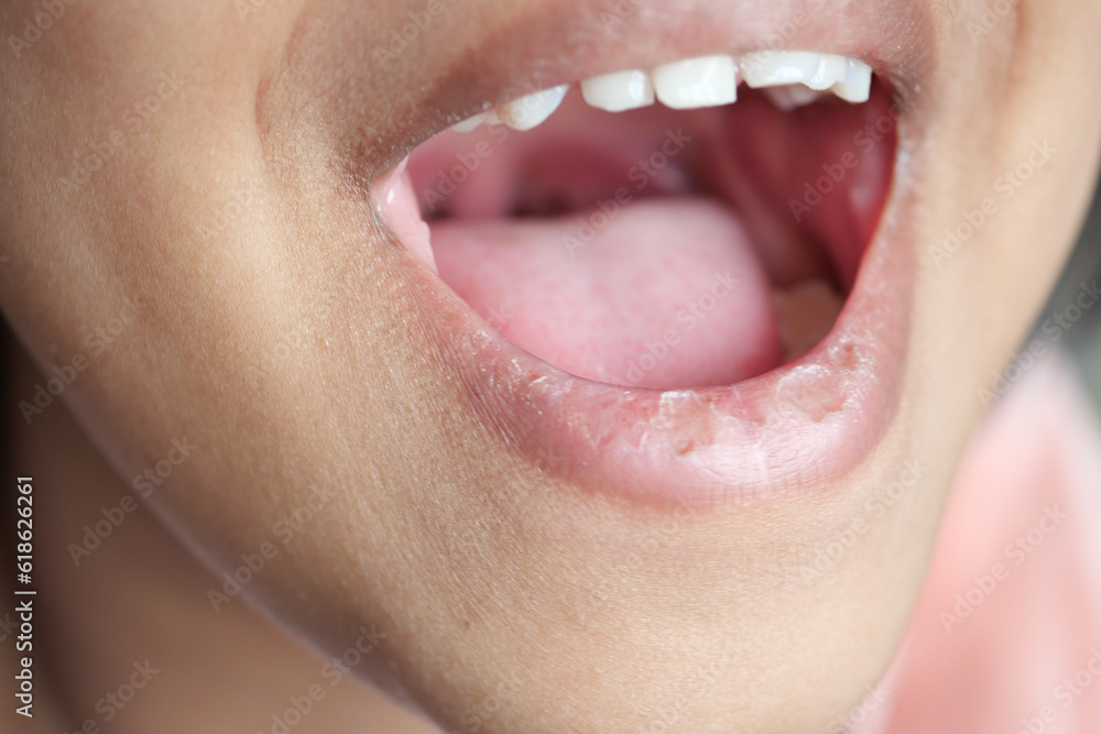 Obraz premium close up of child screaming at home