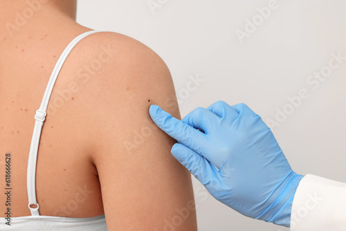 Dermatologist examining patient's birthmark on beige background, closeup © New Africa