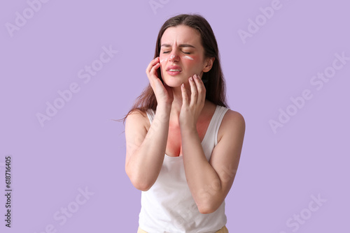 Allergic young woman with sunburned skin and cream on lilac background