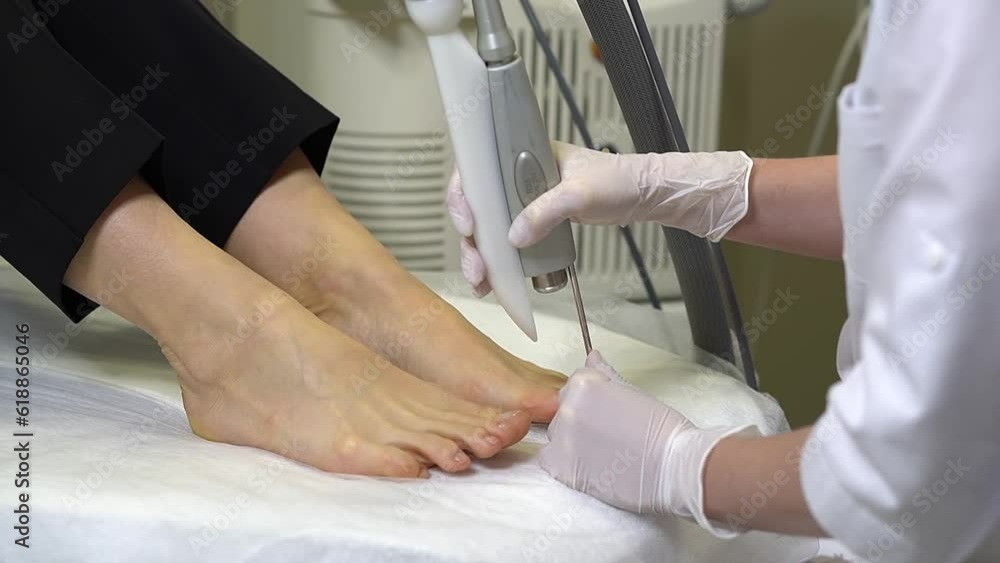 close up woman doctor doing laser treatment procedure for toenail