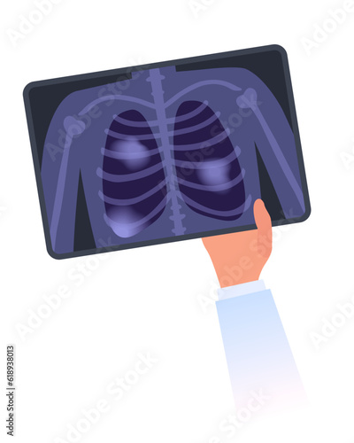 Doctor`s Hand holds X-ray image of damaged human lungs. MRI scan of Pneumonia, pulmonary fibrosis, smoker tuberculosis, dust in lungs or cancer concept. Shortness of breath, chest pain flat isolated