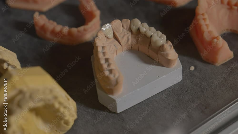 Artificial teeth made from the dentistry material attached to the jaw model. Realistic fake