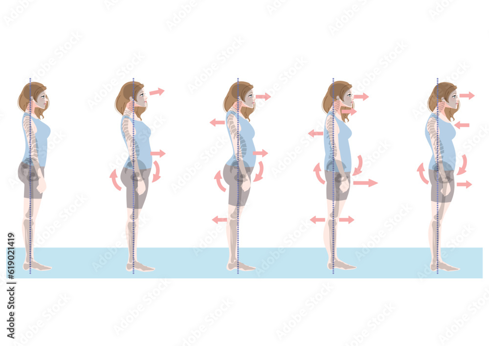 Naklejka premium 横から見た不良姿勢の女性セット