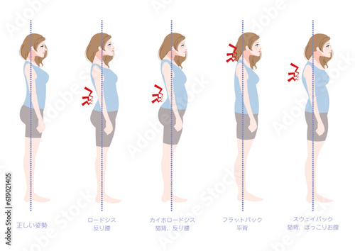 横から見た不良姿勢の女性セット