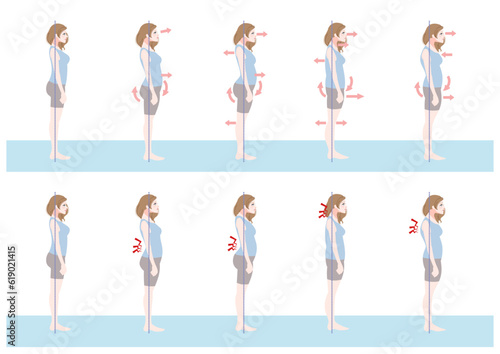 横から見た不良姿勢の女性セット