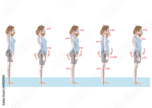 横から見た不良姿勢の女性セット