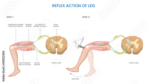 Reflex action of the leg involves an involuntary response to a sensory stimulus, resulting in a rapid and automatic movement to protect or adjust the leg's position for balance or stability.