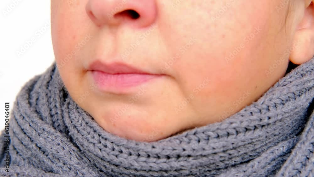 closeup of mature woman 55 years face, sick person with inflamed eyes