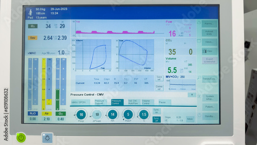 Hospital monitor displaying vital signs: heart rate, blood pressure, pulse oximetry, temperature. Symbolizing health monitoring and medical care