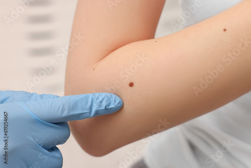 Dermatologist in rubber glove examining patient's birthmark on blurred background, closeup © New Africa