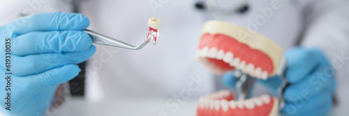 Dentist holding tooth with tweezers and showing jaw model