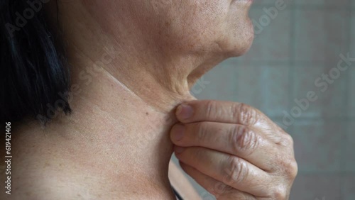 sagging skin on the neck of an elderly woman.