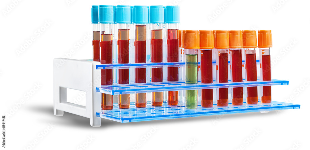 Analysis lab sample of new strain of Coronavirus Omicron. Analysis lab sample of new strain of Coronavirus Omicron.