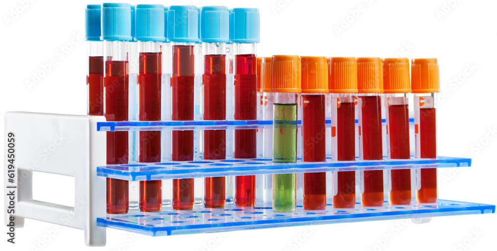 Analysis lab sample of new strain of Coronavirus Omicron. Analysis lab sample of new strain of Coronavirus Omicron.
