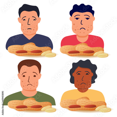 Nut allergy symptoms problem .Swollen man character.Allergic reaction to peanuts.Flat illustration vector.Isolated on a white background.