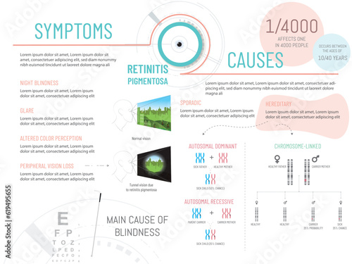 Infographic symptoms and causes of Retinitis pigmentosa.26 September. Includes tunnel vision graphic and genetic scheme on white background.