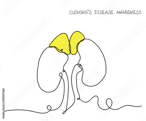 illustration of Cushing disease awareness