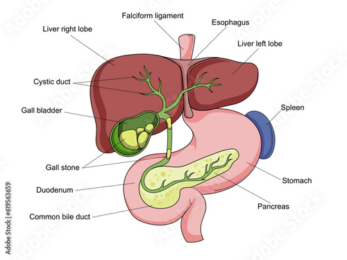 Gallstone structure stone gallbladder diagram schematic vector illustration. Medical science educational illustration