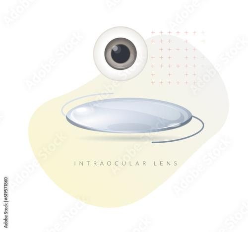Human Eye - Cataract - Intraocular Lense- Illustration