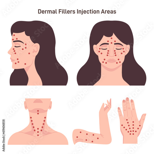 Dermal filler injections sites. Woman face, neck amd hands with hilighted