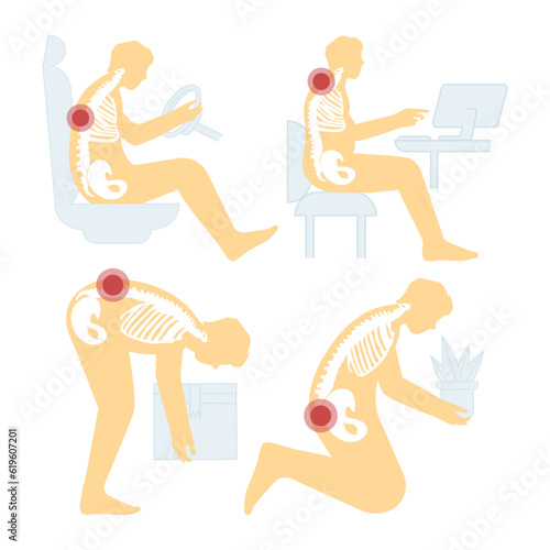 Character suffering from back pain set. Sore back muscles, wrong