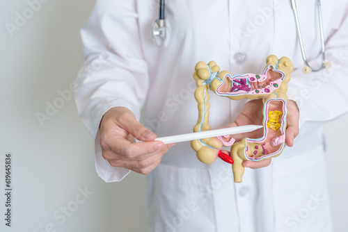 Doctor holding human Colon anatomy model. Colonic disease, Large Intestine, Colorectal cancer, Ulcerative colitis, Diverticulitis, Irritable bowel syndrome, Digestive system and Health concept photo