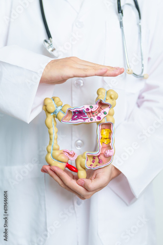 Doctor with human Colon anatomy model. Colonic disease, Large Intestine, Colorectal cancer, Ulcerative colitis, Diverticulitis, Irritable bowel syndrome, Digestive system and Health concept photo