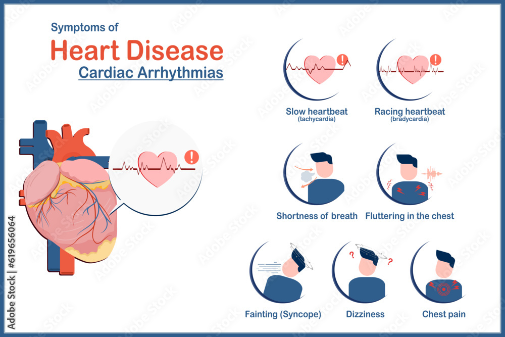 Medical illustration concept, heart disease symptoms caused by irregular heartbeat or cardiac arrhythmias, fatigue, tachycardia, bradycardia, dizziness, chest pain and syncope, flat style