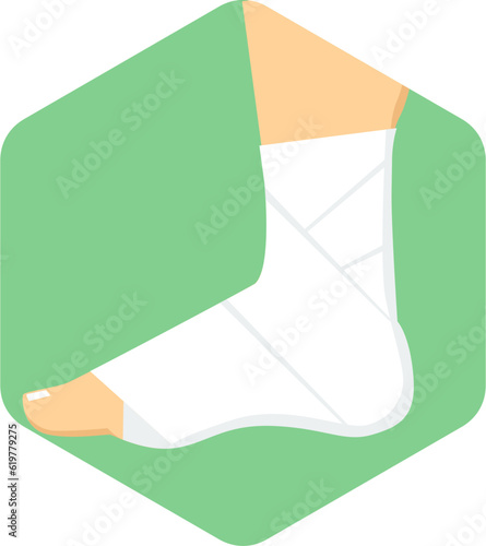 Sprain