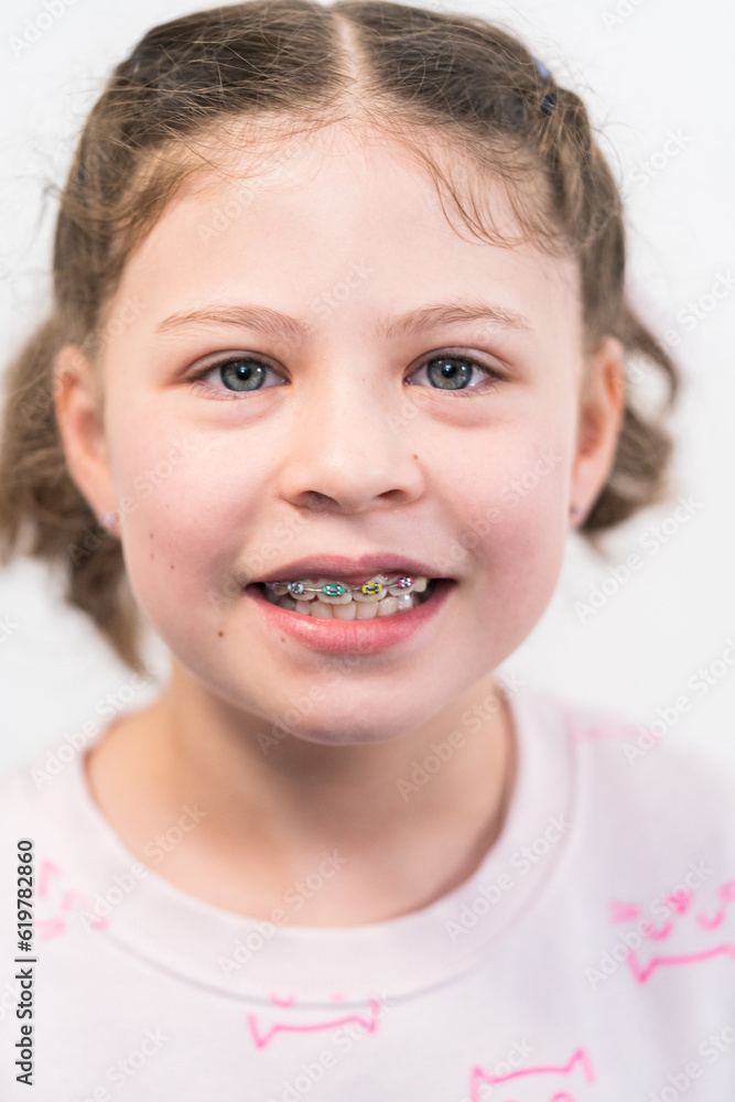 Little girl with rainbow braces Little girl with rainbow braces