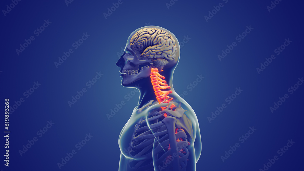 Neck pain or Cervical posture syndrome Neck pain or Cervical posture syndrome
