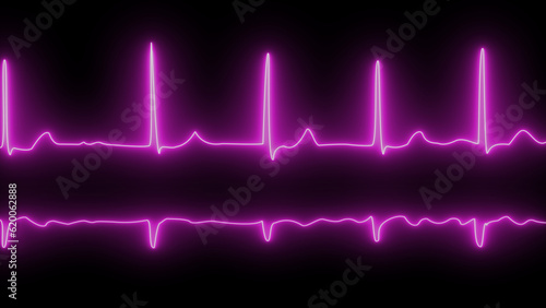 Close up of a medical monitor with purple lines of ECG showing atrial fibrillation. neon Close up of electrocardiogram chart background