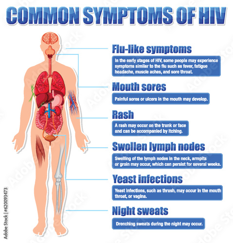 Informative poster of common symptoms of HIV