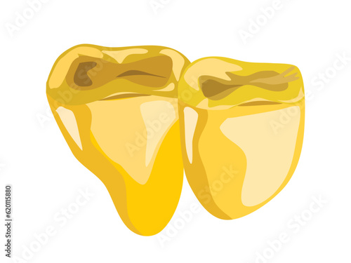 金歯