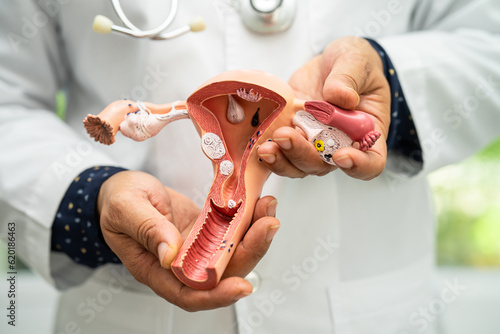 Uterus, doctor holding anatomy model for study diagnosis and treatment in hospital. photo