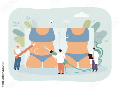Woman body before and after plastic surgery vector illustration. Doctors or surgeons with pencil and syringe marking body parts to be altered. Health care, beauty correction concept