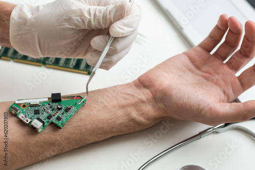 Hand with implantation of micro chip. X-Ray view close-up. Chipization of people, control population