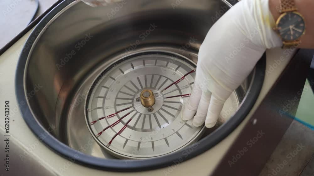 HCT , Hematocrit centrifuge plate with capillary tube , Hematocrit