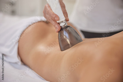 LPG massage, beauty centre, Anti-cellulite. Anti-cellulite roller vacuum massage takes place in medicine salon. Slim problem areas, special body care professional equipment, perform lpg massage